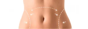 liposuction vücut şekillendirme