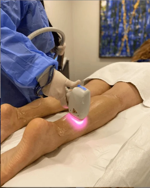 Laser Hair Removal