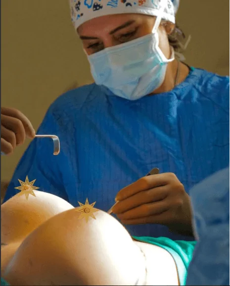 Breast Augmentation