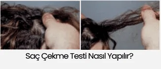 saç çekme testi